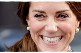 The Secret Behind Kate's Shiny Smile? A Top Dentist Reveals All